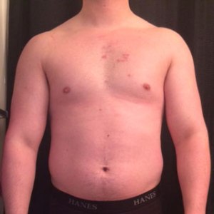 Before Picture, Front