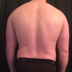 Before Picture, Rear